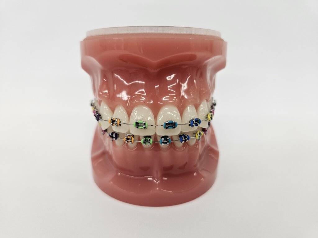 mouth model braces colors